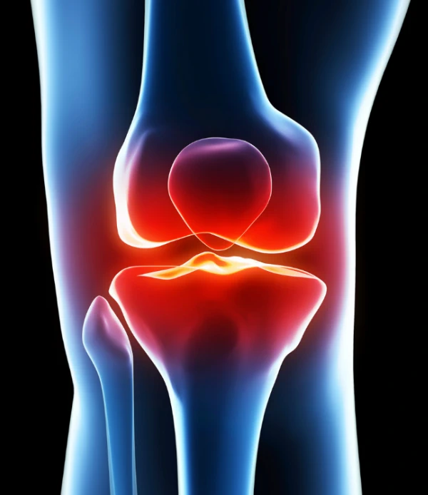 Articulación de la rodilla con dolor